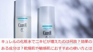 キュレルの化粧水でニキビ増えたのは何故？効果のある成分は？乾燥肌や敏感肌におすすめの使い方とは